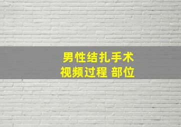 男性结扎手术视频过程 部位